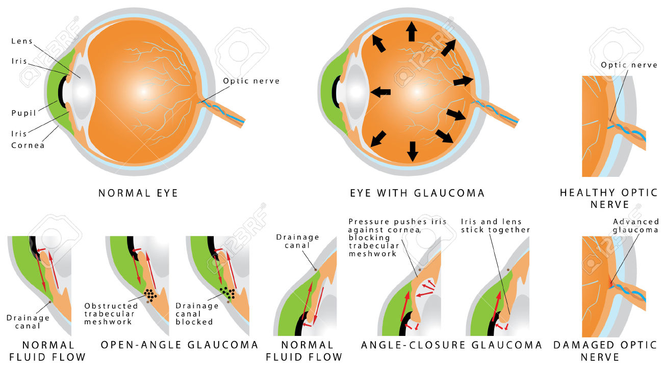  opticals in chennai| opticians in Chennai | contact lens in Chennai | sunglasses in Chennai | eye testing in Chennai | opticals in adyar | cheap and best opticals in chennai