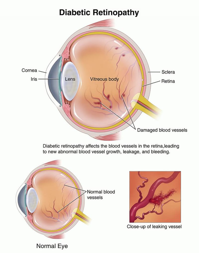 opticals in chennai| opticians in Chennai | contact lens in Chennai | sunglasses in Chennai | eye testing in Chennai | opticals in adyar | cheap and best opticals in chennai