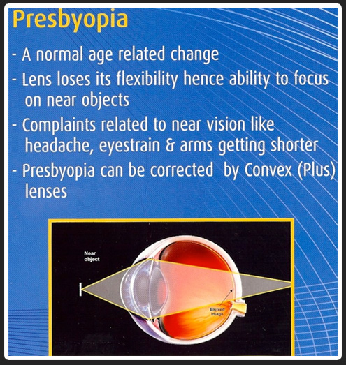  opticals in chennai| opticians in Chennai | contact lens in Chennai | sunglasses in Chennai | eye testing in Chennai | opticals in adyar | cheap and best opticals in chennai