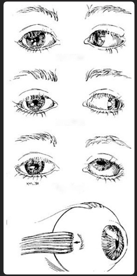 eye-testing-in-indira-nagar