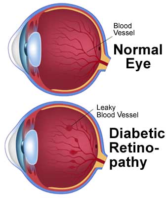  opticals in chennai| opticians in Chennai | contact lens in Chennai | sunglasses in Chennai | eye testing in Chennai | opticals in adyar | cheap and best opticals in chennai