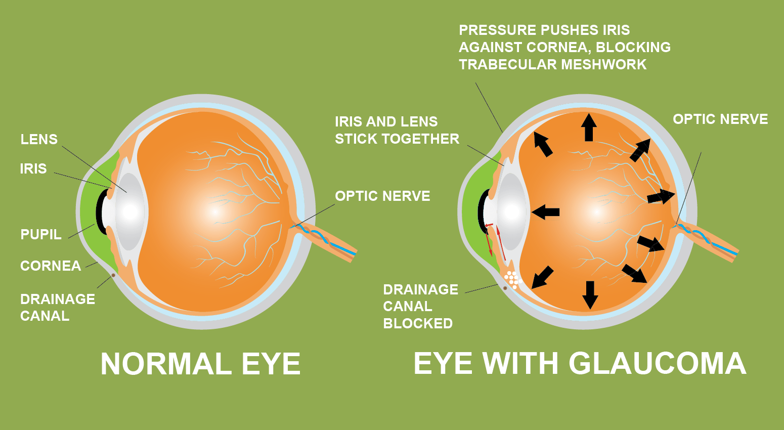  opticals in chennai| opticians in Chennai | contact lens in Chennai | sunglasses in Chennai | eye testing in Chennai | opticals in adyar | cheap and best opticals in chennai
