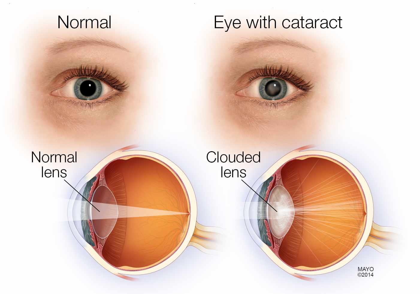  opticals in chennai| opticians in Chennai | contact lens in Chennai | sunglasses in Chennai | eye testing in Chennai | opticals in adyar | cheap and best opticals in chennai